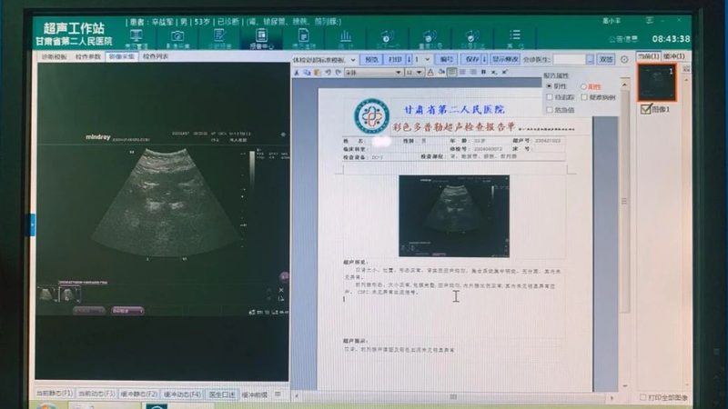 健康管理俱乐部加盟：投资预算的合理规划**